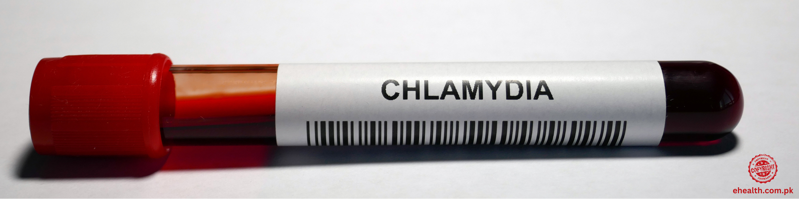 Chlamydia 