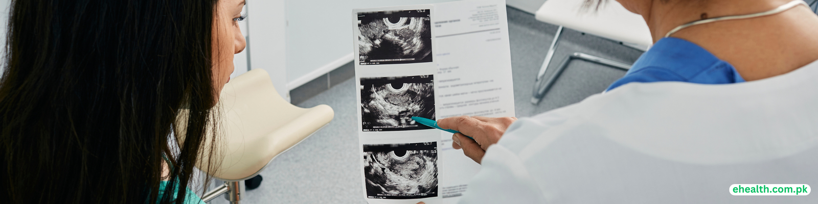 Gynaecological disorders