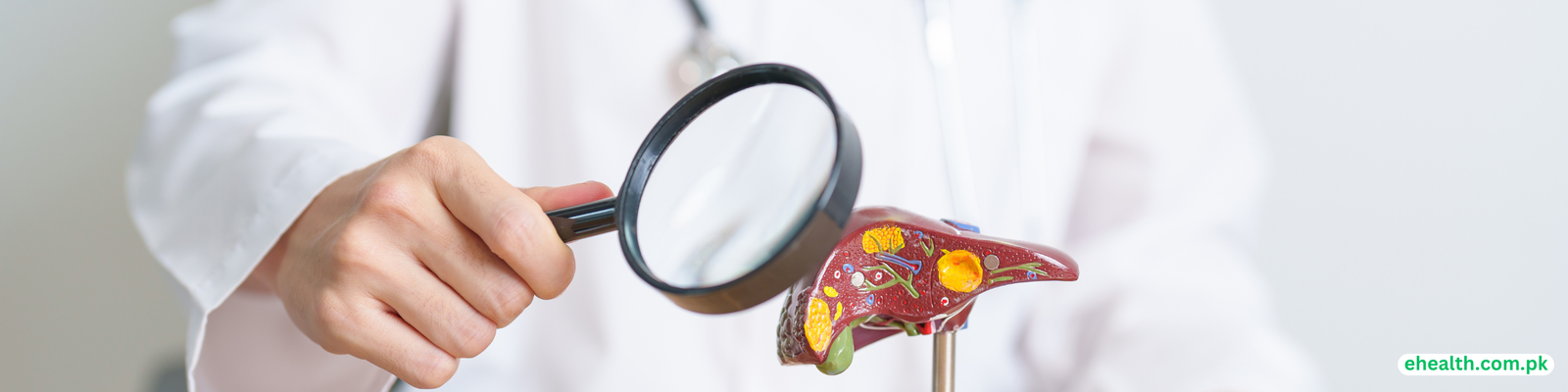 Hepatitis A, B , C & D