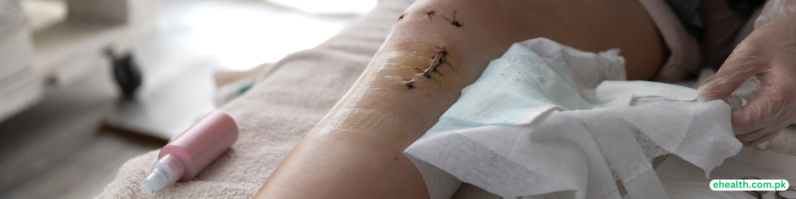 Post-surgical infections